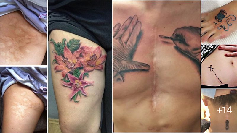 30 ideas to use tattoos to cover scars and birthmarks